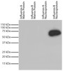 Recombinant influenza proteins were resolved by electrophoresis, transferred to PVDF membrane, and probed with Mouse Anti-Influenza B, Nucleoprotein-HRP (Cat. No. 99-739) . Proteins were visualized with chemiluminescent detection.