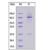 Anti-SARS-CoV-2 Spike RBD Antibody, Chimeric mAb, Human IgM on SDS-PAGE under reducing (R) condition. The gel was stained overnight with Coomassie Blue. The purity of the protein is greater than 85%.