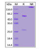 Anti-SARS-CoV-2 Spike NTD Antibody, Chimeric mAb on SDS-PAGE under reducing (R) and non-reducing (NR) conditions. The gel was stained overnight with Coomassie Blue. The purity of the protein is greater than 95%.