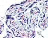 Human placenta tissue stained with IL1R1 Antibody at 10 &#956;g/mL followed by biotinylated anti-mouse IgG secondary antibody, alkaline phosphatase-streptavidin and chromogen.