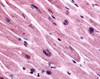 Immunohistochemistry staining of CHRM3 in heart tissue using CHRM3 Antibody.