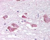 Immunohistochemistry staining of MCHR1 in brain, substantia nigra tissue using MCHR1 Antibody.