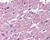 Immunohistochemistry staining of CYSLTR2 in heart tissue using CYSLTR2 Antibody.