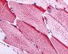 Immunohistochemistry staining of SLC5A10 in skeletal muscle tissue using SLC5A10 Antibody.
