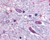 Immunohistochemistry staining of SLC5A3 in spinal cord tissue using SLC5A3 Antibody.