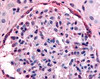 Immunohistochemistry staining of EPHA4 in glomerulus tissue using EPHA4 Antibody.