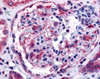 Immunohistochemistry staining of EPHA4 in glomerulus tissue using EPHA4 Antibody.