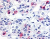 Immunohistochemistry staining of PRLHR in anterior pituitary tissue using PRLHR Antibody.