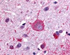 Immunohistochemistry staining of GPRC5B in brain cortex tissue using GPRC5B Antibody.