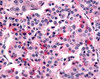 Immunohistochemistry staining of Frizzled 5 in pancreas tissue using Frizzled 5 Antibody.