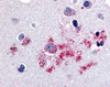 Immunohistochemistry staining of BAI1 in brain tissue using BAI1 Antibody.
