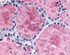 Immunohistochemistry staining of PDE8B in thyroid tissue using PDE8B Antibody.
