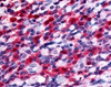 Immunohistochemistry staining of FLT3 in interfollicular zone tissue using FLT3 Antibody.