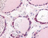 Immunohistochemistry staining of PDE1C in thyroid tissue using PDE1C Antibody.