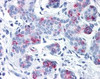 Immunohistochemistry staining of WNT8A in breast tissue using WNT8A Antibody.