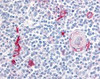 Immunohistochemistry staining of Integrin alpha 4 in thymus, medulla tissue using Integrin alpha 4 Antibody.