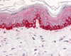 Immunohistochemistry staining of Integrin beta 1 in skin tissue using Integrin beta 1 Antibody.