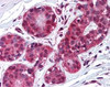 Immunohistochemistry staining of Metalloproteinase Inhibitor 2 in breast tissue using Metalloproteinase Inhibitor 2 monoclonal Antibody.