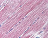 Immunohistochemistry staining of RAB7A in skeletal muscle tissue using RAB7A Antibody.