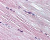 Immunohistochemistry staining of AMPD1 in skeletal muscle tissue using AMPD1 Antibody.
