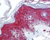 Immunohistochemistry staining of FOXO3 in skin (formalin-fixed paraffin embedded) tissue using FOXO3 Antibody.