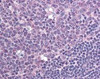 Immunohistochemistry staining of CXCR7 in tonsil (formalin-fixed paraffin embedded) tissue using CXCR7 Antibody.