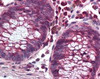 Immunohistochemistry staining of Nadph Oxidase 1 in colon (formalin-fixed paraffin embedded) tissue using Nadph Oxidase 1 Antibody.