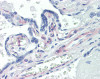 Human placenta tissue stained with PDGFRB Antibody, alkaline phosphatase-streptavidin and chromogen.