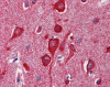 Human brain cortex tissue stained with CYCS Antibody, alkaline phosphatase-streptavidin and chromogen.