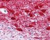 Immunohistochemistry staining of MAP2 in brain cortex tissue using MAP2 monoclonal Antibody.