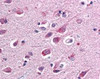 Immunohistochemistry staining of SARM1 in brain cortex tissue using SARM1 monoclonal Antibody.