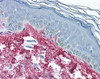 Immunohistochemistry staining of in skin tissue using Antibody.