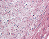 Immunohistochemistry staining of ELTD1 in human colon, smooth muscle tissue using ELTD1 Antibody.
