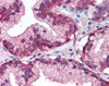 Immunohistochemistry staining of EGF Receptor in prostate tissue using EGF Receptor Antibody.