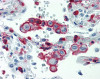 Immunohistochemistry of human lung tissue stained using CD18 Monoclonal Antibody.