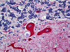 Immunohistochemistry of human cerebellum tissue stained using Beta III Tubulin Monoclonal Antibody.