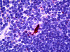 Immunohistochemistry of human lyphoid-dendritic cells stained using EBI3 Monoclonal Antibody.