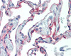 Human lung tissue stained with ICAM1 Antibody, alkaline phosphatase-streptavidin and chromogen.