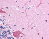 Immunohistochemistry of human cerebellum tissue stained using Beta III Tubulin Monoclonal Antibody.