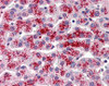 Human liver tissue stained with Transthyretin Antibody at 1:50 followed by biotinylated anti-mouse IgG secondary antibody, alkaline phosphatase-streptavidin and chromogen.