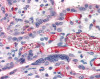 Immunohistochemistry staining of Fibrinogen in placenta tissue using Fibrinogen Antibody.