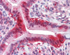 Immunohistochemistry of human small intestine tissue stained using LDHA Monoclonal Antibody.