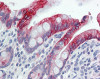 Immunohistochemistry of human small intestine tissue stained using Cytokeratin 20 Monoclonal Antibody.