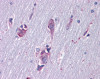 Immunohistochemistry of Human brain cortex tissue stained using Islet 1 Monoclonal Antibody.