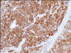 Immunohistochemistry staining of MLANA in human melanoma (4 microns) tissue using MLANA Antibody.