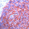 Immunohistochemistry staining of SLC2A1 in human esophagus tissue using SLC2A1 monoclonal Antibody.