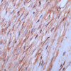 Immunohistochemistry staining of Beta Actin in leiomyoma tissue using Beta Actin Antibody.