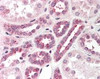 Immunohistochemistry staining of PNKP in kidney tissue using PNKP Antibody.