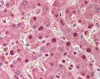 Immunohistochemistry staining of PPP1R13L in liver tissue using PPP1R13L Antibody.