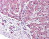 Immunohistochemistry staining of PPARA in liver tissue using PPARA Antibody.